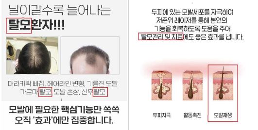 식약처가 가정의 달을 맞아 온라인에서 식품, 의료기기, 화장품 거짓·과장 광고 사례를 212건 적발했다. 그 중 탈모에 효과잇는 의료기기처럼 광고하는 경우가 60건으로 가장 많다(사진: 식품의약품안전처 제공).